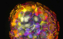 Anthrobots科学家用人类气管细胞制造微型生物机器人
